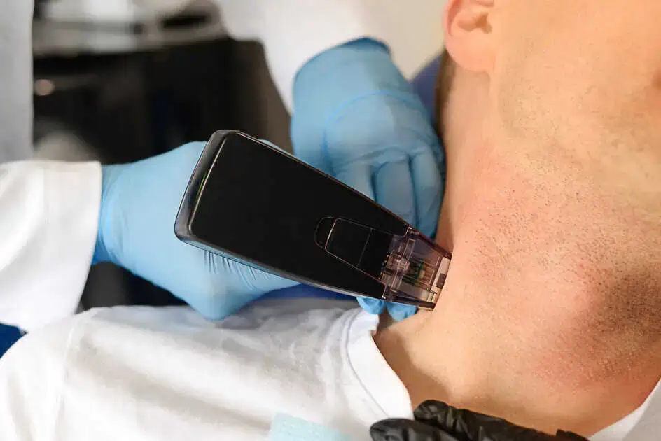 Morpheus8 Treatments by Envi Aesthetics in Aldie, Virginia
